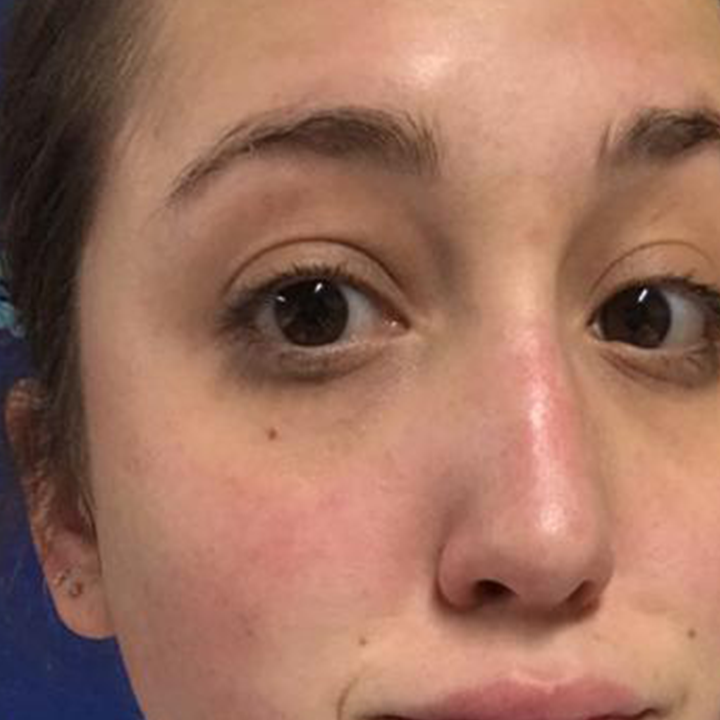M2 Serum Pestañas antes y después
